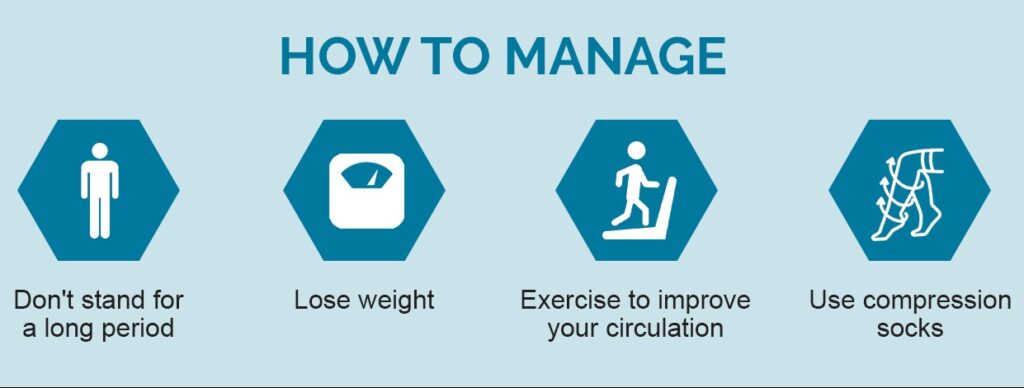 varicose vein management